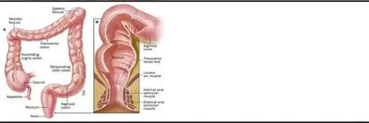 FECAL INCONTINENCE IN ADULTS